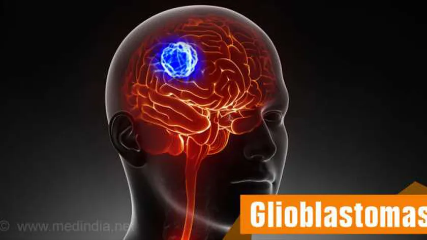 10755588571664264671 سرطان المخ - تعبيرية