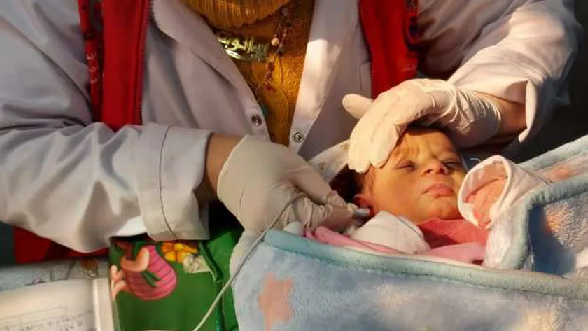 فحص الأطفال